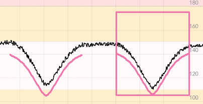 Facilitator_Shape_FHR_duplicate.PNG