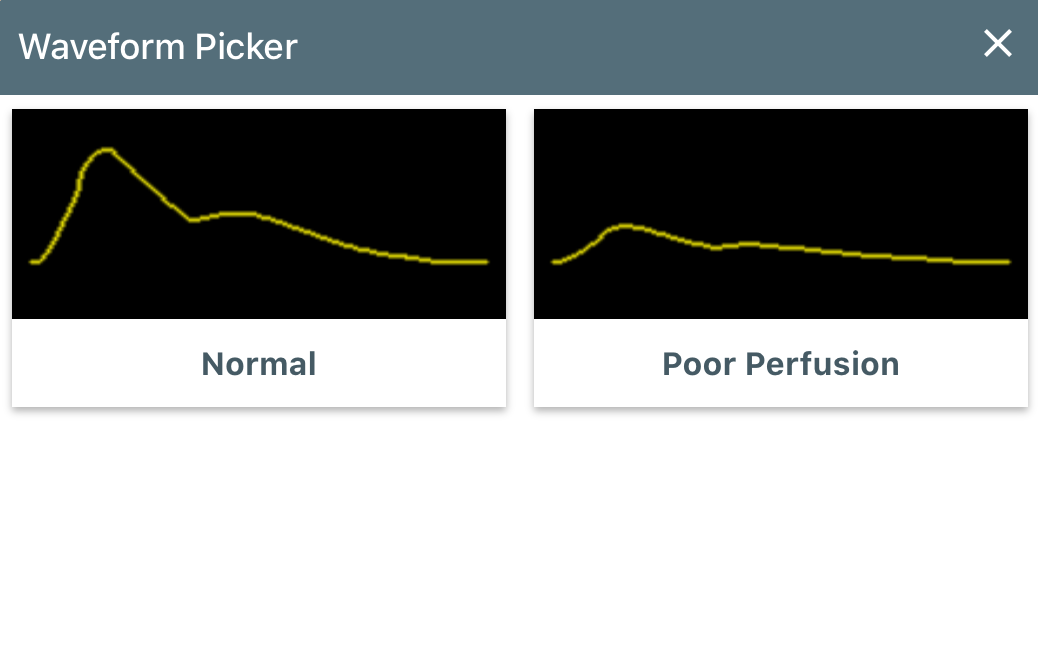 SpO2_waveform.PNG