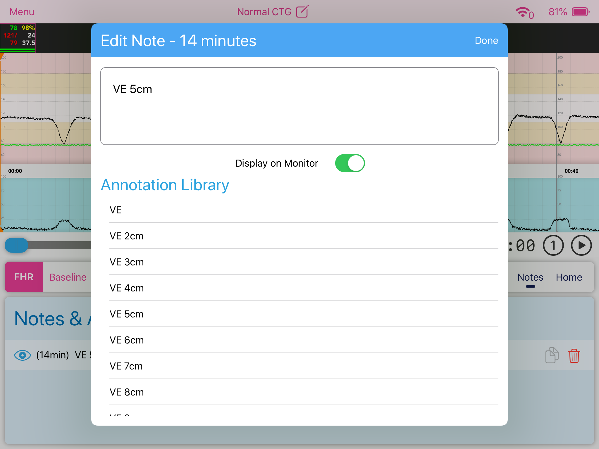 Facilitator_Notes_added.PNG
