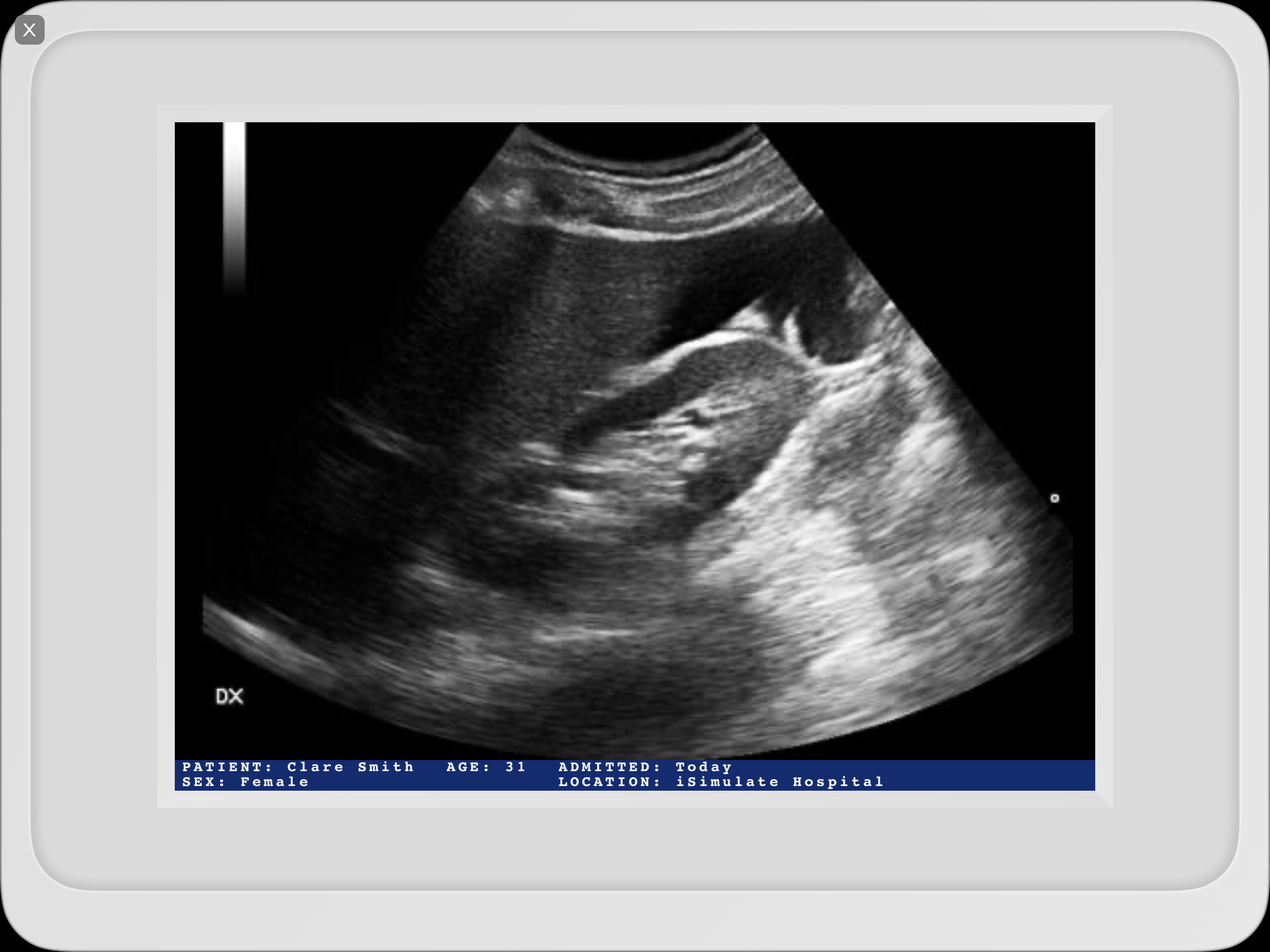 Media_Ultrasound.PNG