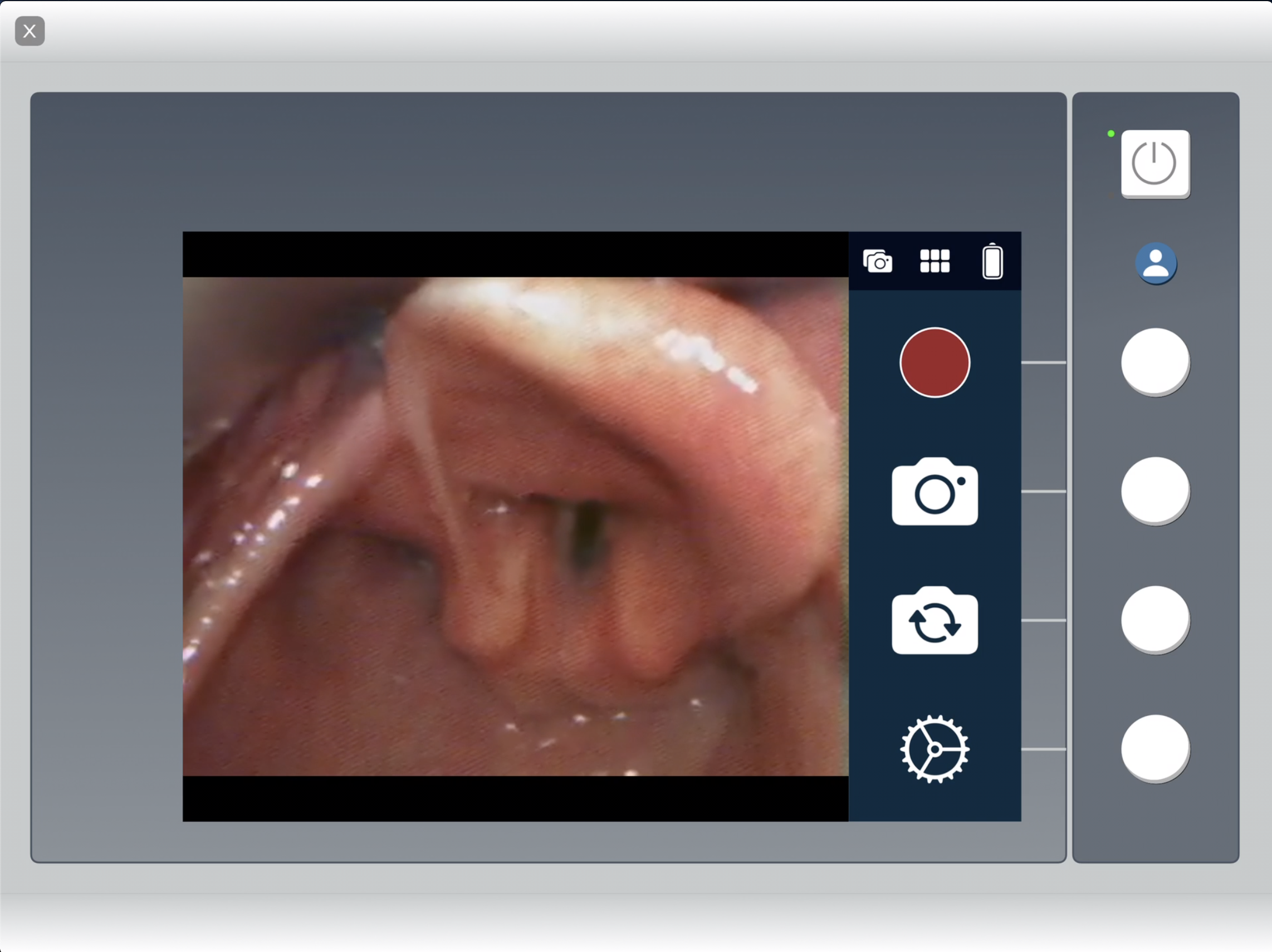 Media_Laryngoscope_Image.png