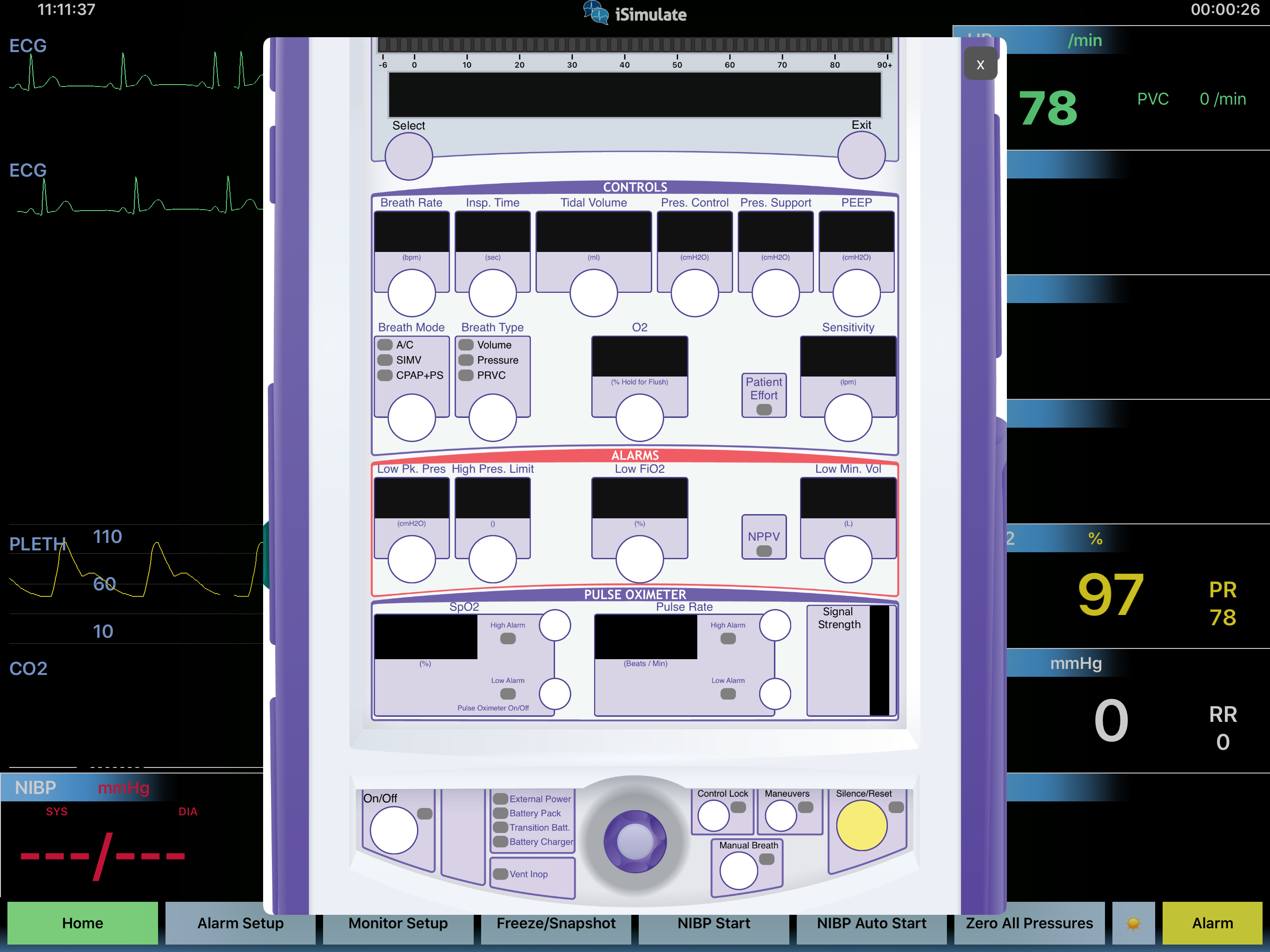 Show_Ventilator.PNG