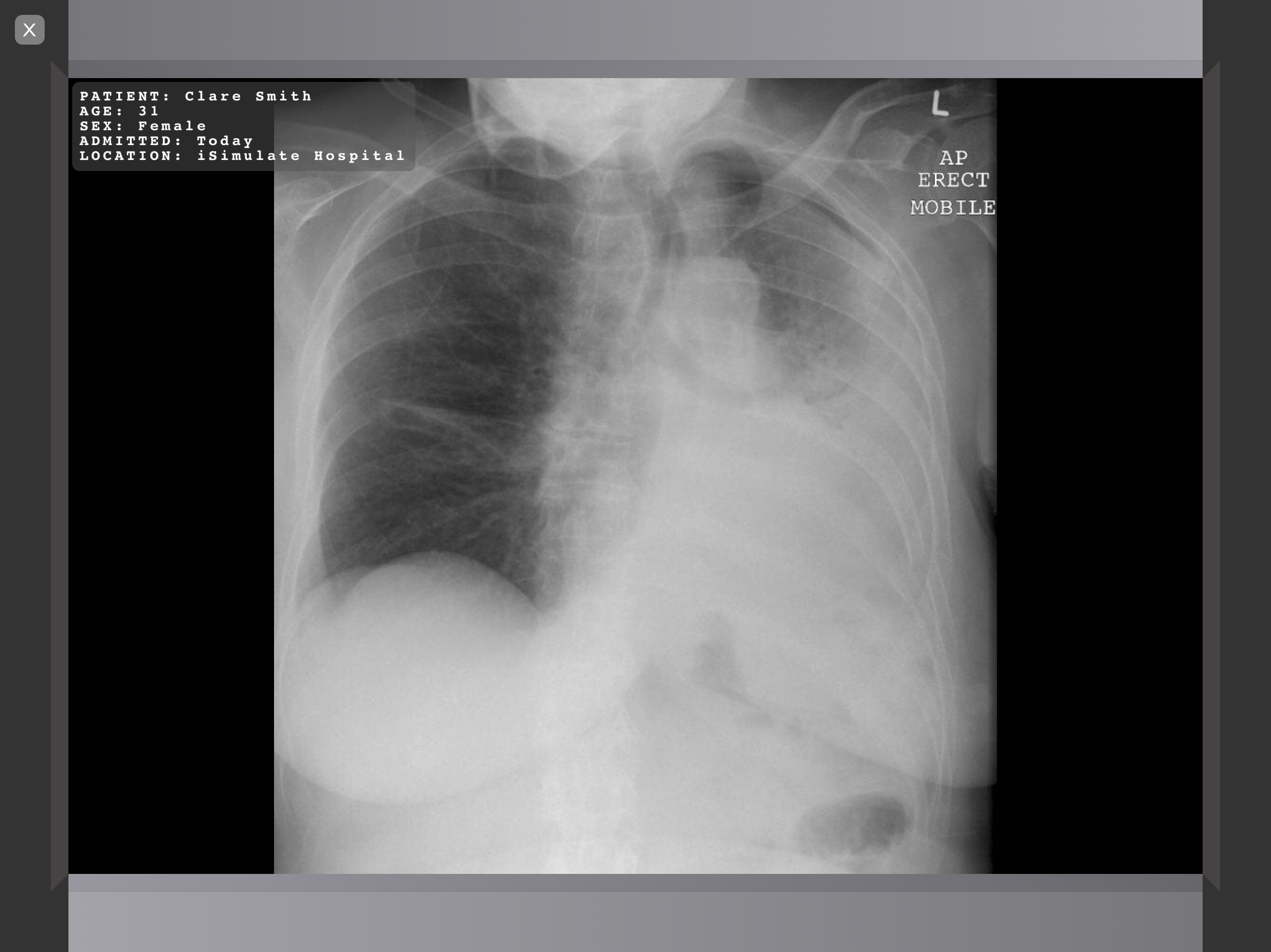 Media_Radiograph.PNG