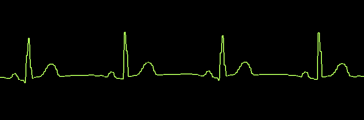 Waveform_smoothing_off.PNG