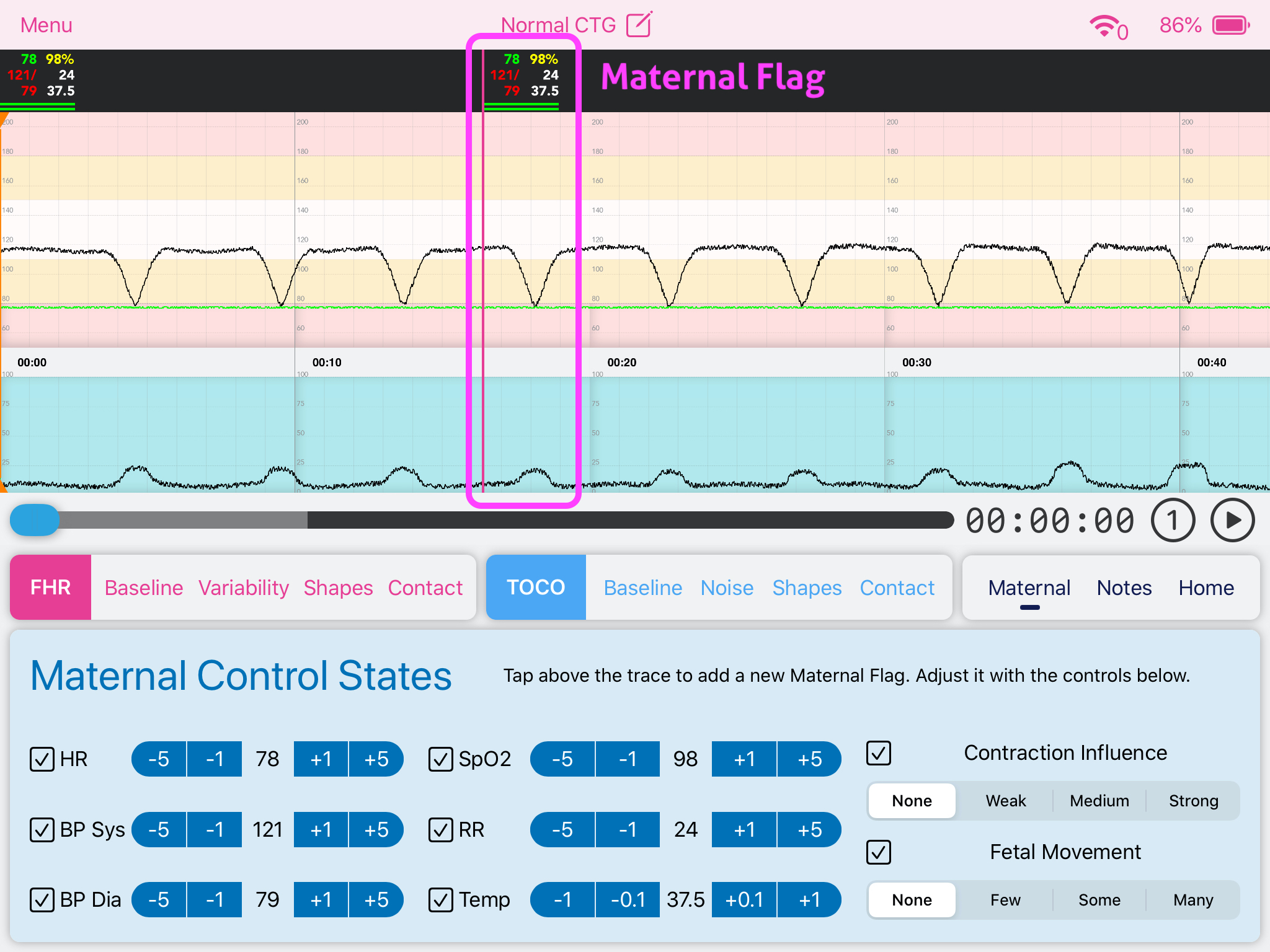 Facilitator_Maternal_Parameter_Editor.jpeg