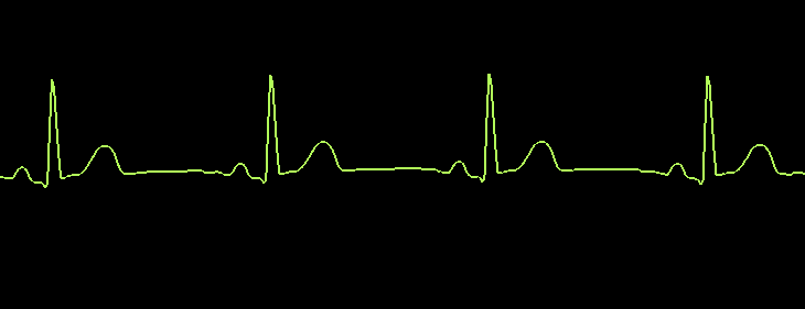 Waveform_smoothing_on.PNG