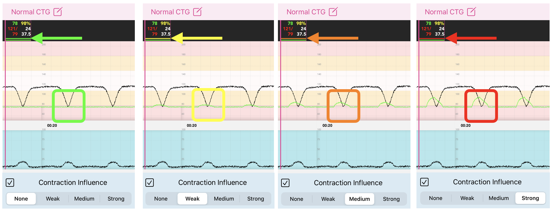 Facilitator_Maternal_Contraction_Influence.png
