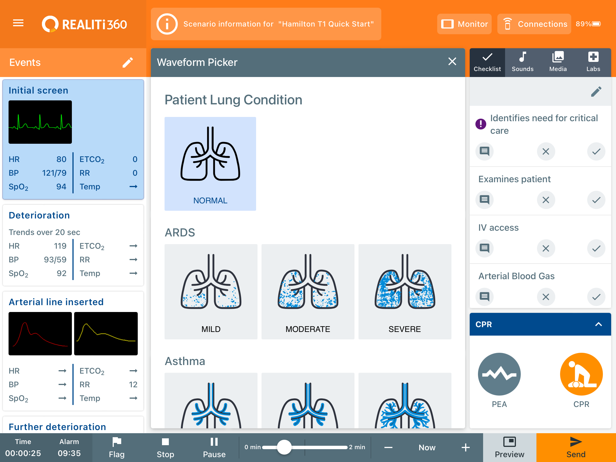 Patient_Lung_Condition_2.PNG