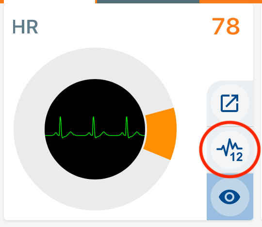 Elektrode_Placement_button.PNG