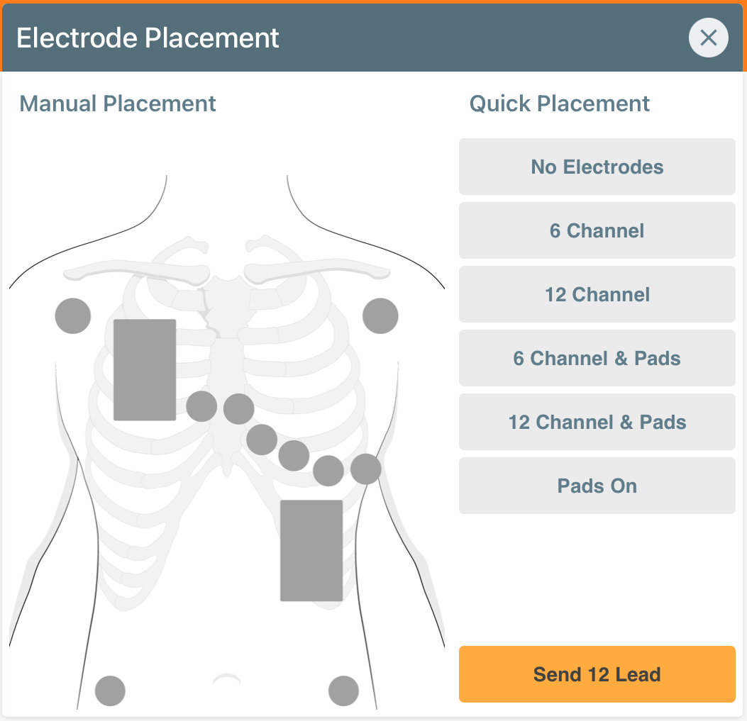 Elektrode_Placement_-_all_off.PNG