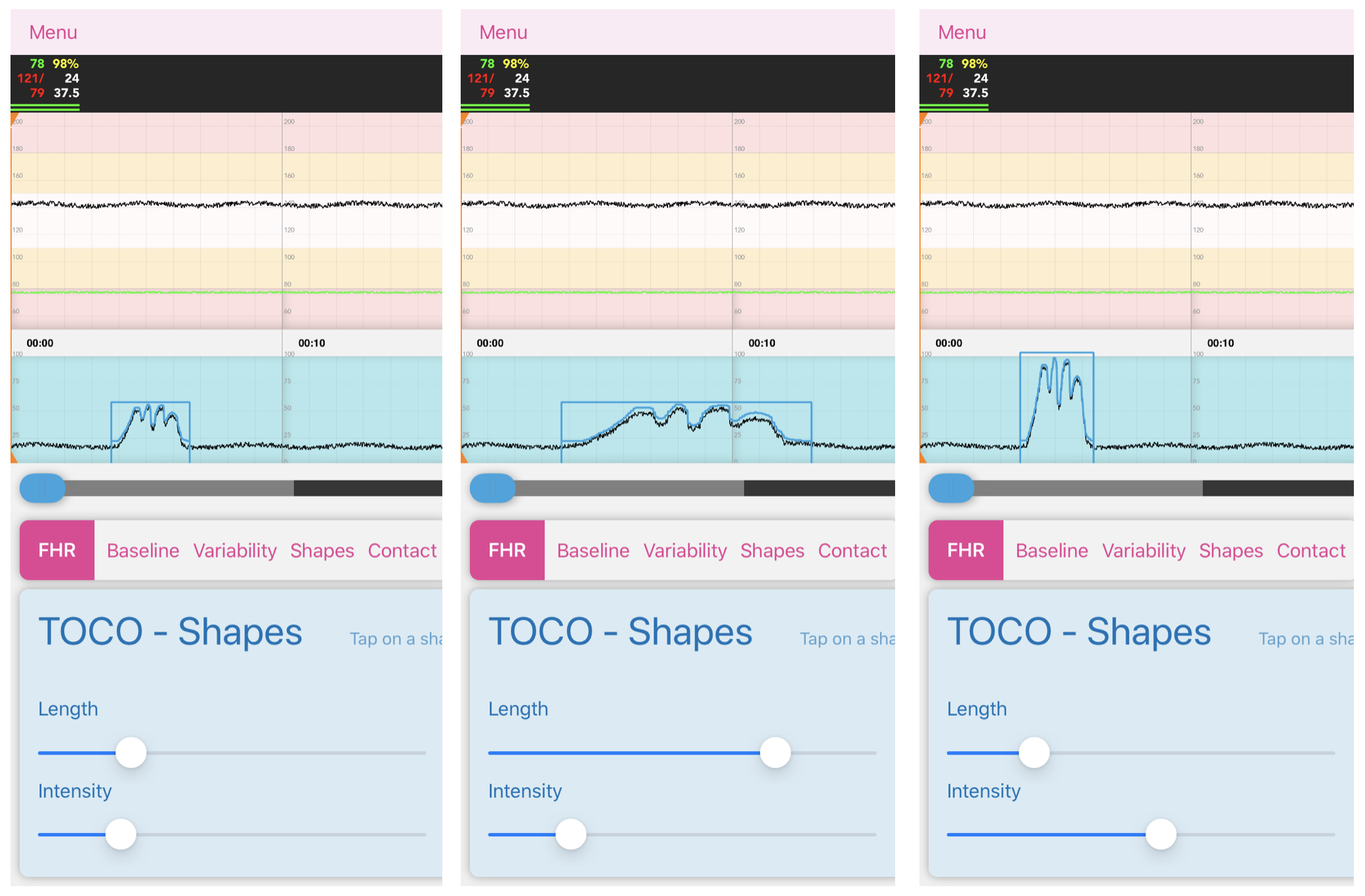 Facilitator_Toco_Shape_adjust.png