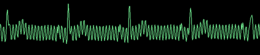 Electrical_Interference.PNG