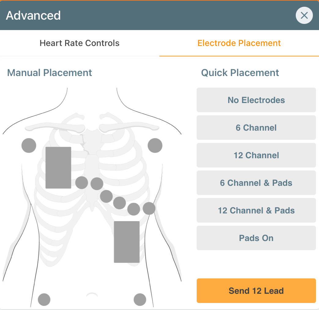 HR_Advanced_Electrode_Placement.PNG
