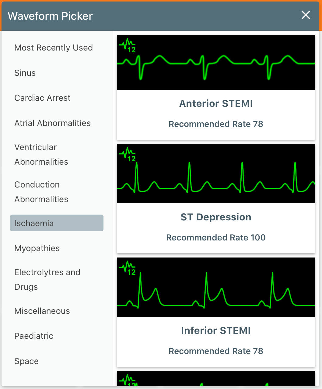 Wavefomr_Picker_ECG.PNG