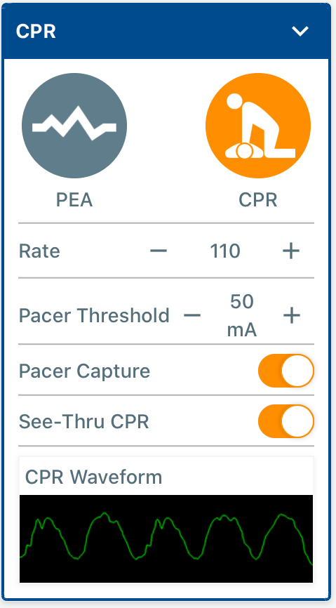 CPR_and_Pacing_Controls.PNG