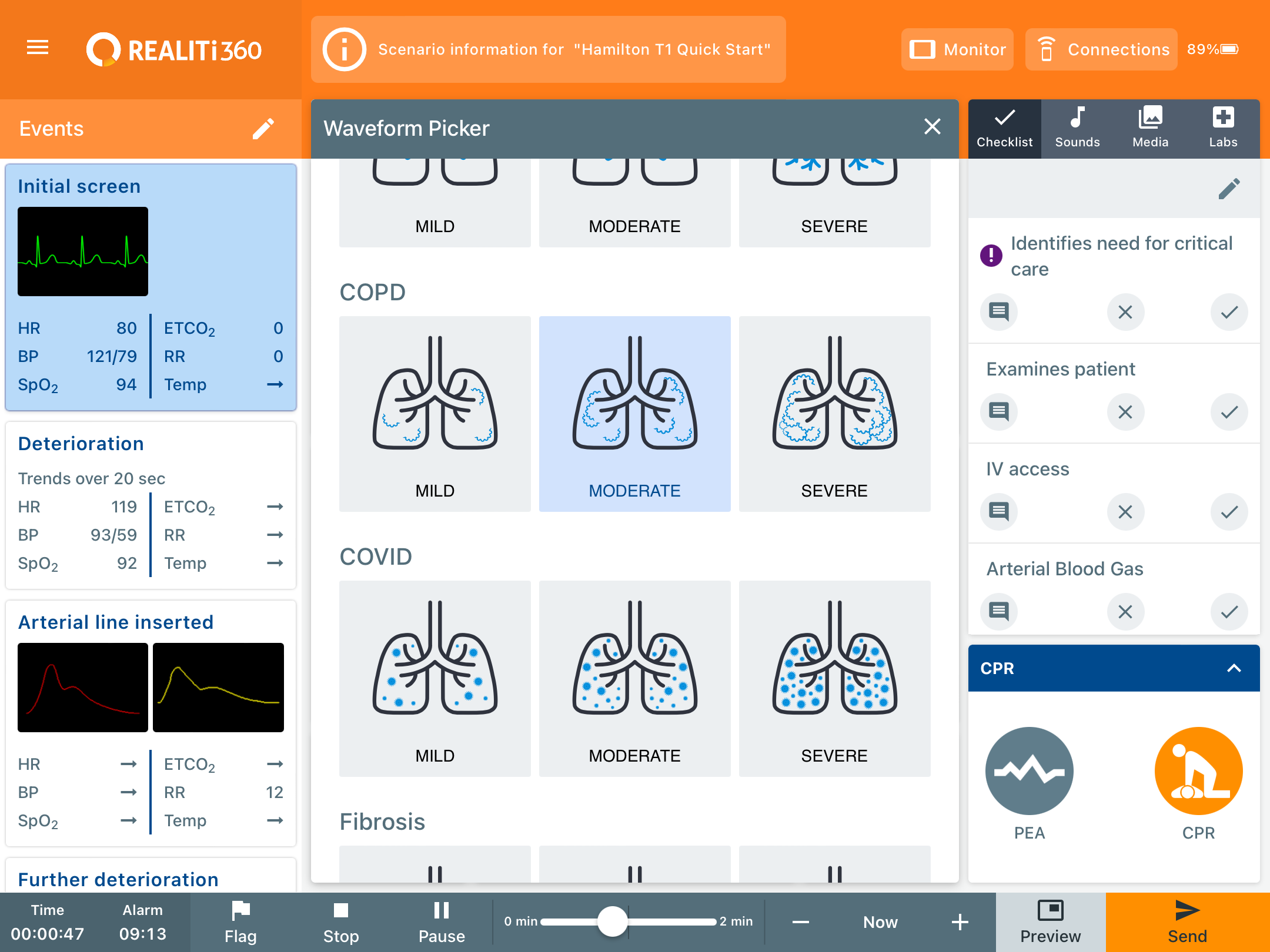Patient_Lung_Condition.PNG